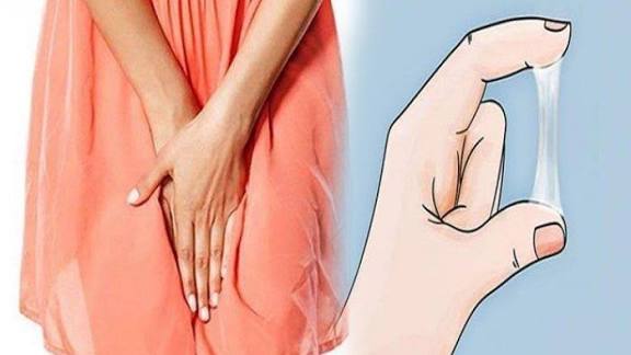 Gambar Ilustrasi Keputihan